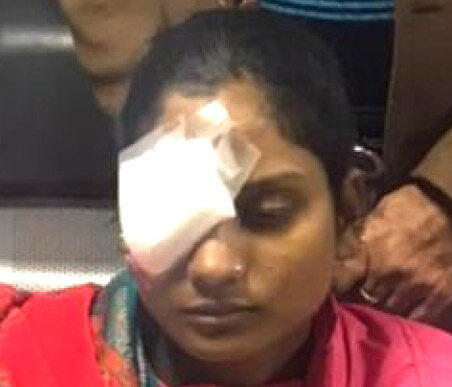 A patient treated under Mission Gift of Sight