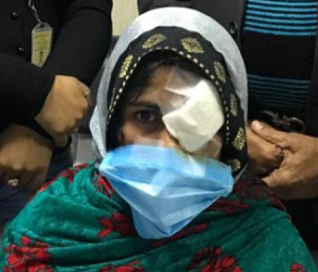 A patient treated under Mission Gift of Sight