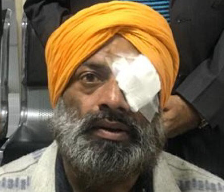 A patient treated under Mission Gift of Sight