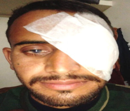A patient treated under Mission Gift of Sight