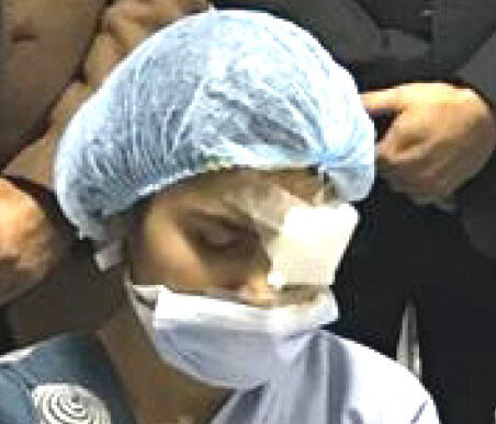 A patient treated under Mission Gift of Sight