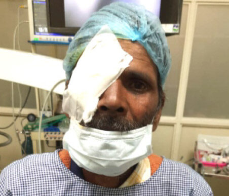 A patient treated under Mission Gift of Sight