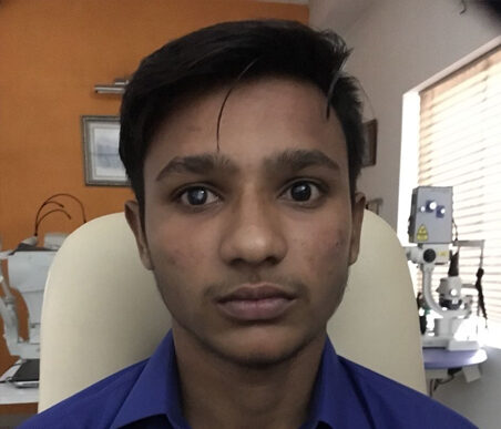 A patient treated under Mission Gift of Sight
