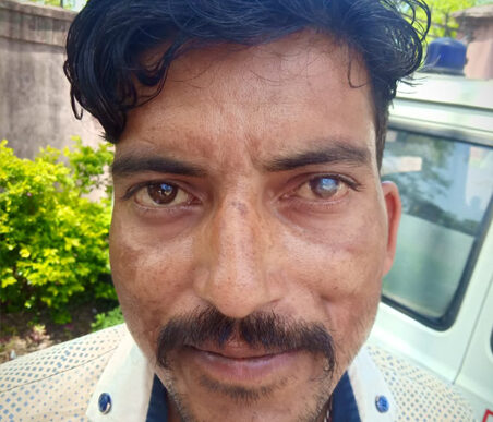 A patient treated under Mission Gift of Sight